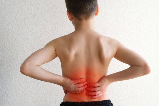 Naked Back Of Boy, Child 8-10 Years Old Grabbed A Sore Spot, Curved Spine, Red Spot As Symbol Of Pain In Spine, Concept Of Osteochondrosis, Scoliosis, Back Pain, Intervertebral Hernia