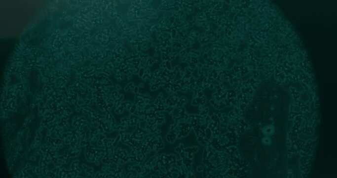 Cancer Cells Under Microscope At Laboratory