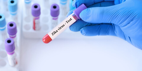 Doctor holding a test blood sample tube with Zika virus test on the background of medical test tubes with analyzes. Banner. Copy space