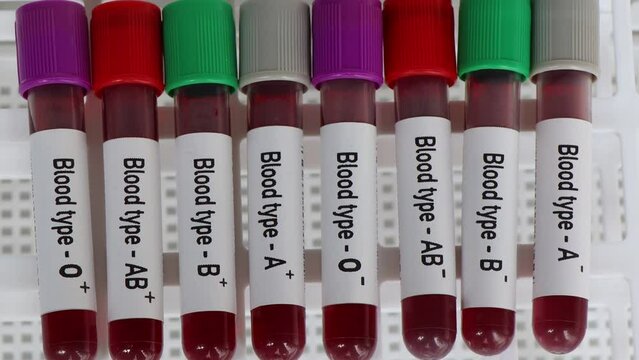 Blood type Rh positive and negative test, blood sample to analyze in the laboratory, blood in test tube