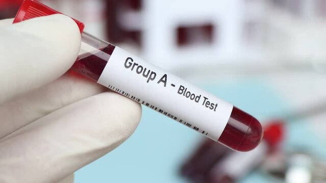 Group A- Blood Test, blood sample to analyze in the laboratory, blood in test tube