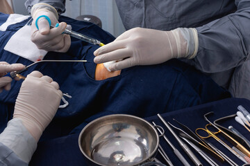 A cosmetic surgeon injects local anesthesia into the nose prior to an open rhinoplasty procedure, while a nurse stands by with a nasal aspirator.