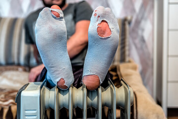 Brocken worn out socks on human legs on heating radiator. Concept of poverty, bankruptcy, poor, debt