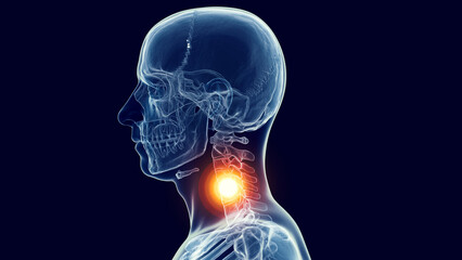 3d medical illustration of a man's skull and cervical spine. neck pain