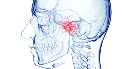3d medical illustration of a man's skull and cervical spine. jaw pain - 603017855