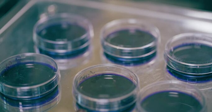 Petri Dishes Cooling, Medical Laboratory Cancer Research Covic 19 Pandemic