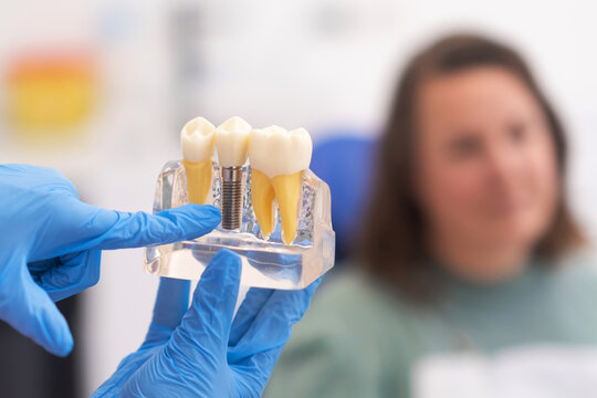 dental implants, dentist discussing a treatment plan with patient holds a dental implant model, emphasizing the importance of patient education in modern dental clinics. 