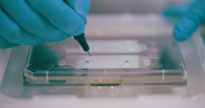 Scientist Working in Medical Laboratory Cancer Research Covic 19 Pandemic