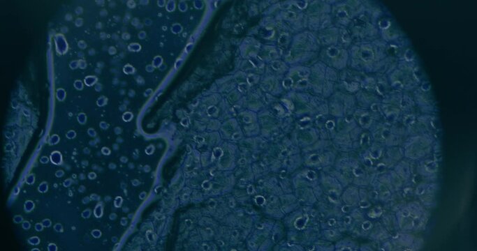 Cancer Cells Under Microscope At Laboratory
