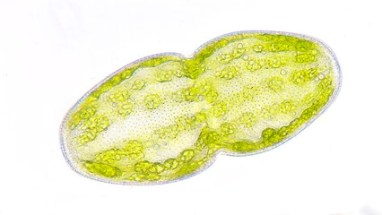 Freshwater microalgae belonging to desmid group, Cosmarium turgidum or also known as Actinotaenium...