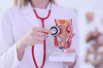 Doctor holds artificial model of rectum with stethoscope