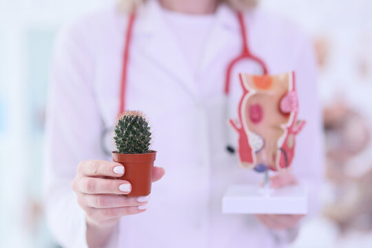 Gynecologist shows cactus and female reproductive organs