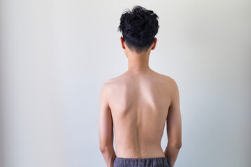 back view of boy with scoliosis, spinal nerve. isolated on white background