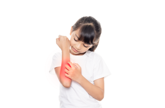 Little girl has skin rash allergy and itchy on her arm.