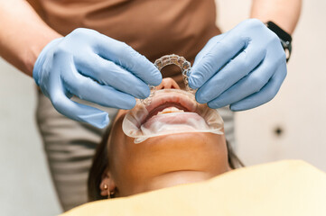 Woman in the stomatology clinic, visiting dentist, installing the aligner