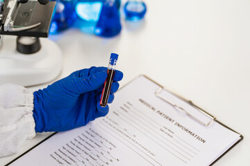 Doctor holding blood vessels for analysis and checking blood in research laboratory blood sample...