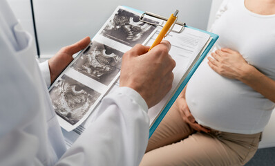 Visit to obstetrician gynecologist by pregnant woman for scheduled check-up. Pregnancy consultant - obrazy, fototapety, plakaty