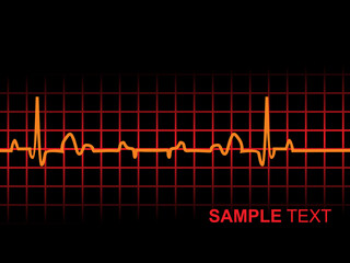 lifeline in an electrocardiogram, illustration