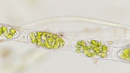 Asexual reproduction of Spirogyra sp. by forming zygospore. Fresh sampel without staining