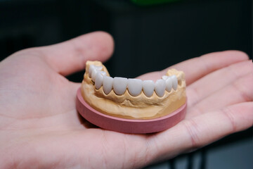 A jaw with ceramic teeth. Dentist's device in the hand. Close-up