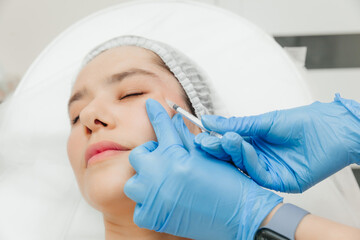 Close-up of the hands of a beautician injecting Botox into a woman's forehead. Correction of forehead and eye wrinkles with botulinum toxin.