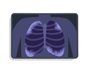 XRAY of Lungs Damaged by Pneumonia. Image of Acute Respiratory infection. Visualized by MRI or Scanner Inflammation of the Lungs. Chronic obstructive pulmonary disease vector flat illustration 