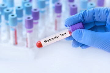 Doctor holding a test blood sample tube with Pertussis test on the background of medical test tubes...