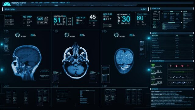 
 Medical Profile of Patient Showing Head and Brain MRI Scan. Vital Signs and Several Healthcare Information. Futuristic Technological Interface Analyzing Human Anatomy.