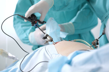 Surgical team.Laparoscopic instruments in the hands of a surgeon. Modern abdominal...