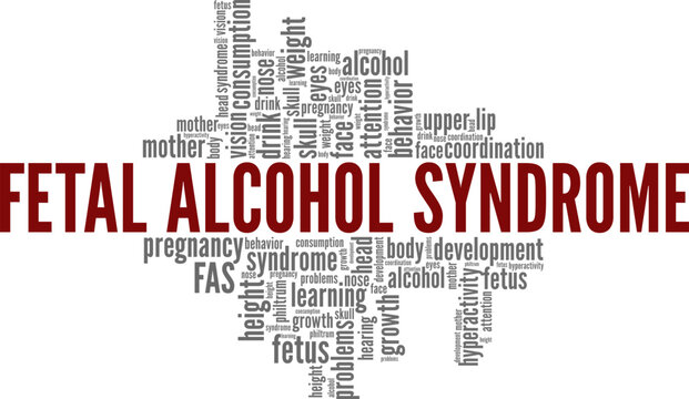 FAS - Fetal Alcohol Syndrome word cloud conceptual design isolated on white background.