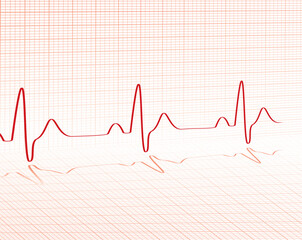 heart beat red grid layed over a background with room for your own text