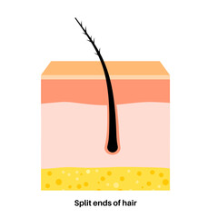 Split hair ends