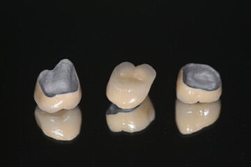Macro shot of crowns. Dental PFM (non precious) with all porcelain baked.