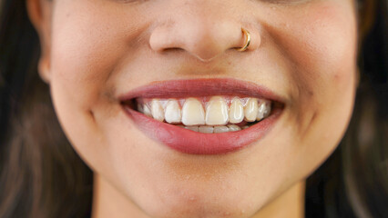 Young Asian Indian woman holding removable invisible aligner, also known as invisalign or  clear...