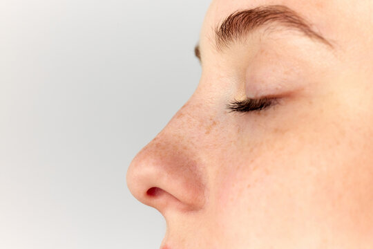Young woman, girl demonstrating nose after, before surgery over white studio background. Side view. Rhinoplasty