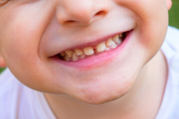 Cheerful child, 2-year-old boy laughing, close-up of part of the child's face, children's mouth, concept of sensory feelings, sincere emotions, speech disorders, development exercises