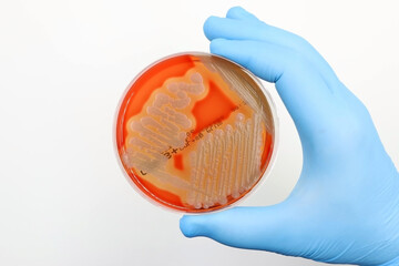 The rise of antibiotic-resistant bacterial infections. Doctor's or researcher's hand with a...