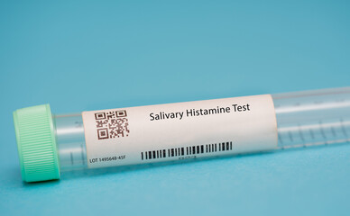 Salivary Histamine Test