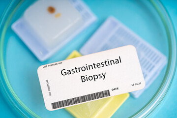 Gastrointestinal Biopsy