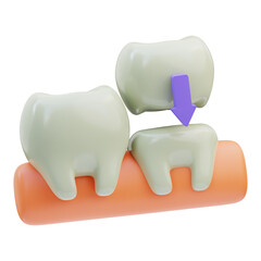 Dental Crown 3D Illustration