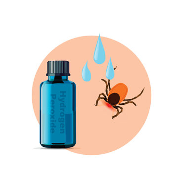 Removing encephalitis ticks after bite. How to remove mite. Parasite carrying disease.Disinfect with hydrogen peroxide.