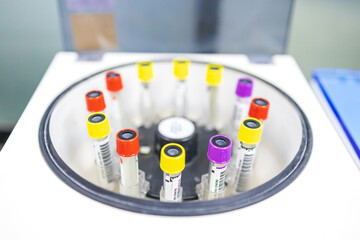Laboratory equipment centrifuge in hospital or clinic.White medical centrifuge with blood...