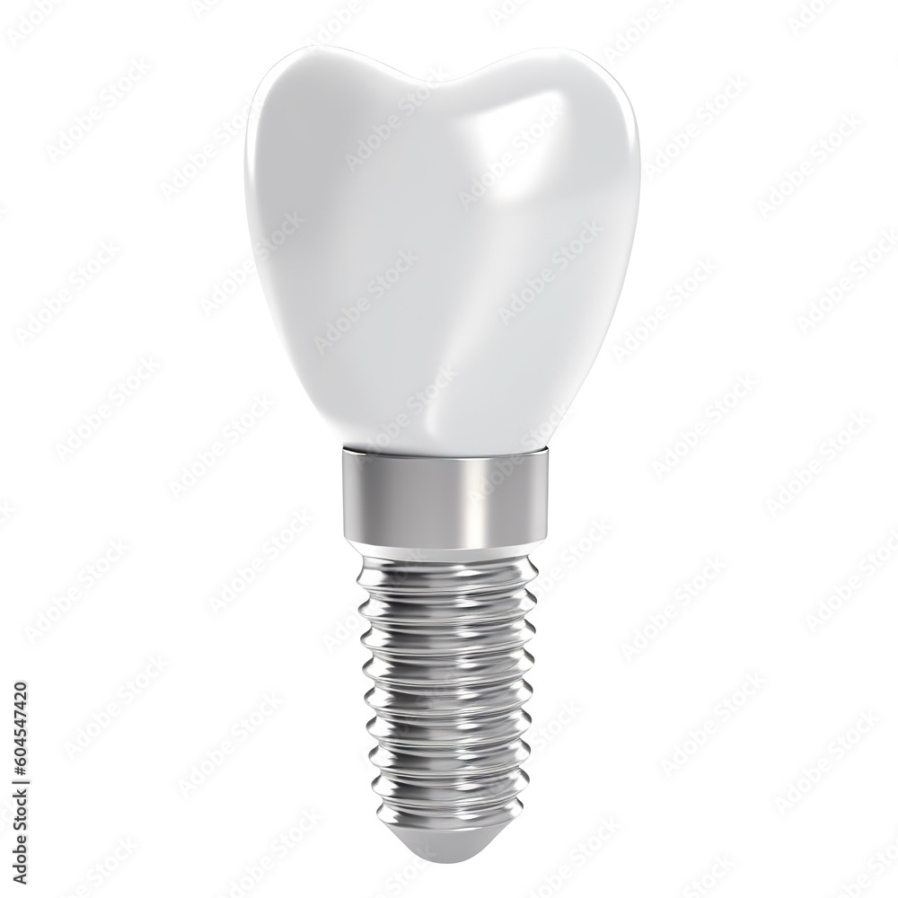 Wall mural dental implant model of molar tooth, cut out, as a concept of implantation teeth and dental surgery. - Wall murals