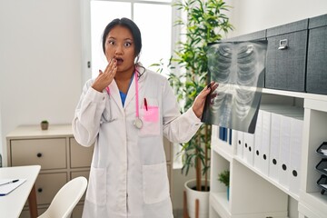 Young asian doctor woman holding chest x-ray covering mouth with hand, shocked and afraid for...