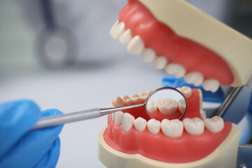 Fototapeta na wymiar Dentist using mouth mirror inspects teeth back side on model