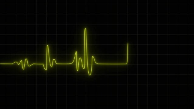 Ekg - electrocardiogram: Heartbeat Monitor in Glowing yellow as 4k Rendered Animation Footage. yellow heartbeat pulse rhythm on electrocardiogram, type monitor, 