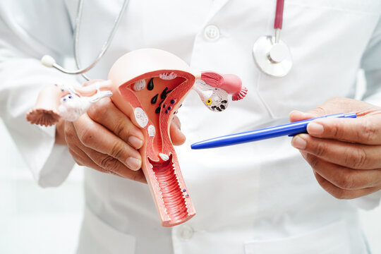 Uterus, doctor holding anatomy model for study diagnosis and treatment in hospital.