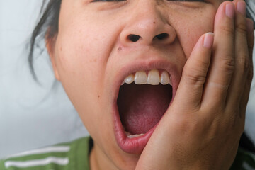 Asian woman holding her hand on her cheek feeling toothache, tooth decay, gingivitis or bad breath...