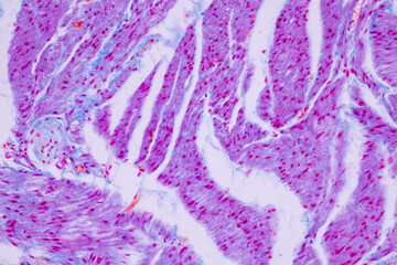 Histological Smooth muscle human under the microscope for education.