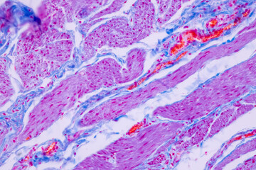 Histological Smooth muscle human under the microscope for education.